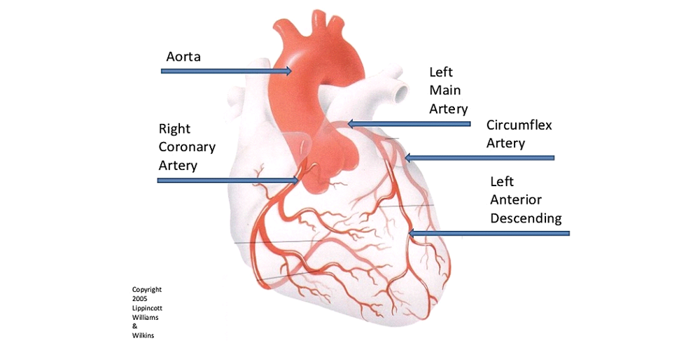 coronary-angiography